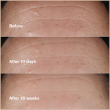 Smart Clinical Repair Wrinkle Correcting Serum
