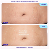 Tighten & Smooth Belly Cream – Firming Body Cream with MicroTight4 Complex, Hyaluronic Acid & Shea Butter – 4.25 oz