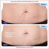 Tighten & Smooth Belly Cream – Firming Body Cream with MicroTight4 Complex, Hyaluronic Acid & Shea Butter – 4.25 oz