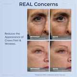 Plexaderm Rapid Reduction Eye Serum – Temporary Under-Eye Smoothing Serum for Bags, Fine Lines, Wrinkles, Dark Circles & Crow’s Feet – Pump