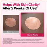 10% Niacinamide Dark Spot Correcting Serum with Tranexamic Acid & Arbutin for Brightening