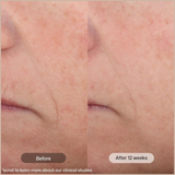 Tinted Face Moisturizer SPF 45 with Peptides & Vitamin C for Anti-Aging, Brightening & Hydration