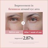 Retinol & Salmon PDRN Eye Serum for Fine Lines, Firming & Puffiness Reduction