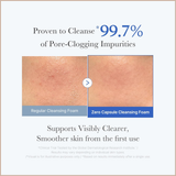 AHA/BHA/PHA Deep Cleansing Foam for Blackhead Removal & Pore Care